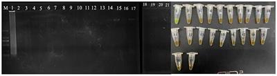 Development of a Direct and Rapid Detection Method for Viable but Non-culturable State of Pediococcus acidilactici